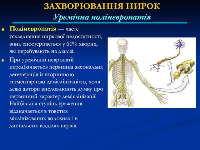 ЗАХВОРЮВАННЯ НИРОК Уремічна поліневропатія Поліневропатія — часте ускладнення ниркової недостатності, вона