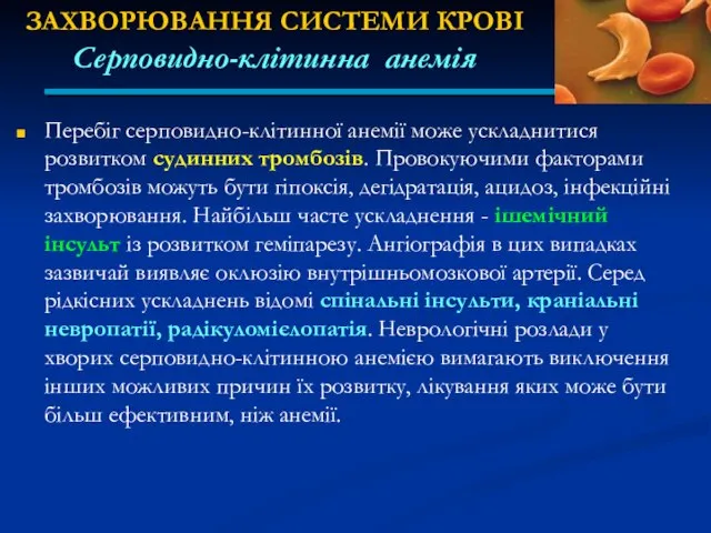 ЗАХВОРЮВАННЯ СИСТЕМИ КРОВІ Серповидно-клітинна анемія Перебіг серповидно-клітинної анемії може ускладнитися розвитком