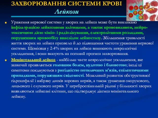 ЗАХВОРЮВАННЯ СИСТЕМИ КРОВІ Лейкози Ураження нервової системи у хворих на лейкоз