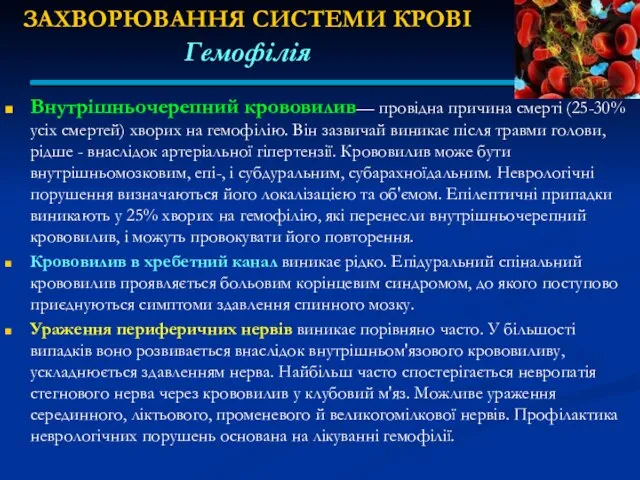 ЗАХВОРЮВАННЯ СИСТЕМИ КРОВІ Гемофілія Внутрішньочерепний крововилив— провідна причина смерті (25-30% усіх