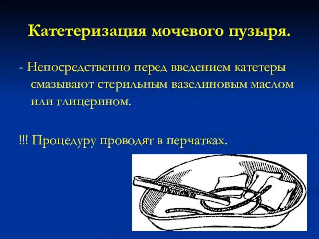 Катетеризация мочевого пузыря. - Непосредственно перед введением катетеры смазывают стерильным вазелиновым