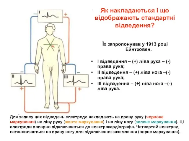 Як накладаються і що відображають стандартні відведення? Їх запропонував у 1913