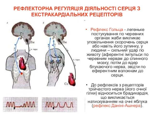 РЕФЛЕКТОРНА РЕГУЛЯЦІЯ ДІЯЛЬНОСТІ СЕРЦЯ З ЕКСТРАКАРДІАЛЬНИХ РЕЦЕПТОРІВ Рефлекс Гольца - легеньке