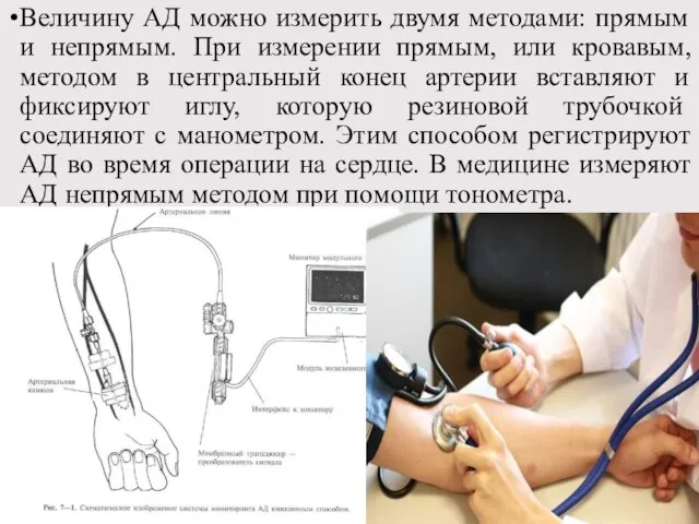 Величину АД можно измерить двумя методами: прямым и непрямым. При измерении