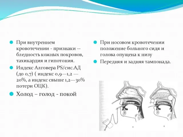 При внутреннем кровотечении - признаки --бледность кожных покровов, тахикардия и гипотония.