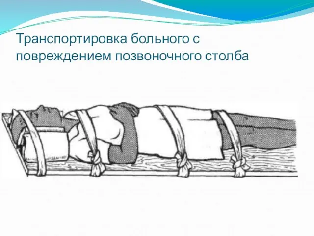 Транспортировка больного с повреждением позвоночного столба