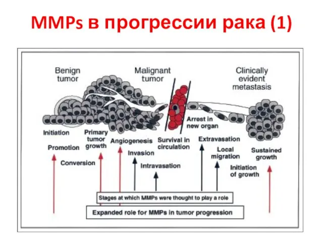 MMPs в прогрессии рака (1)