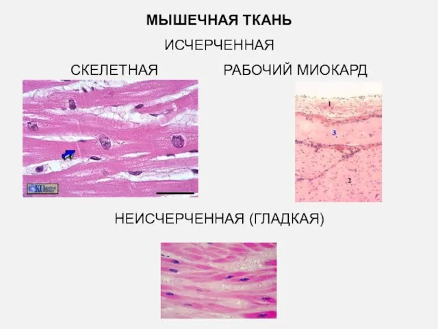 МЫШЕЧНАЯ ТКАНЬ ИСЧЕРЧЕННАЯ СКЕЛЕТНАЯ РАБОЧИЙ МИОКАРД НЕИСЧЕРЧЕННАЯ (ГЛАДКАЯ)