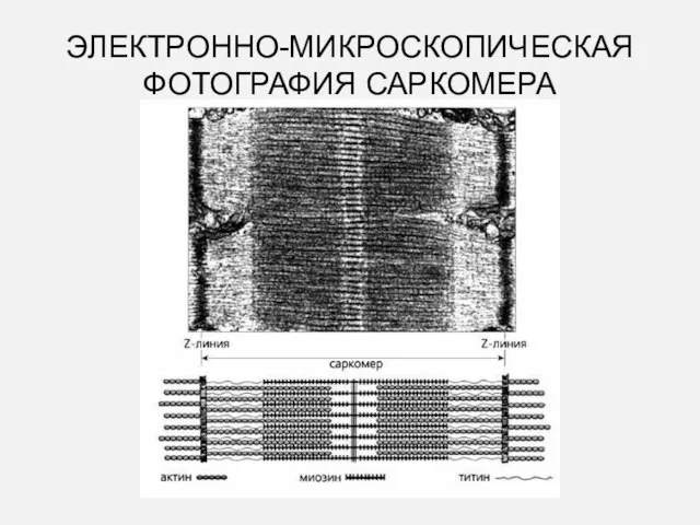 ЭЛЕКТРОННО-МИКРОСКОПИЧЕСКАЯ ФОТОГРАФИЯ САРКОМЕРА