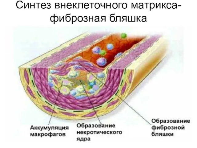 Синтез внеклеточного матрикса-фиброзная бляшка