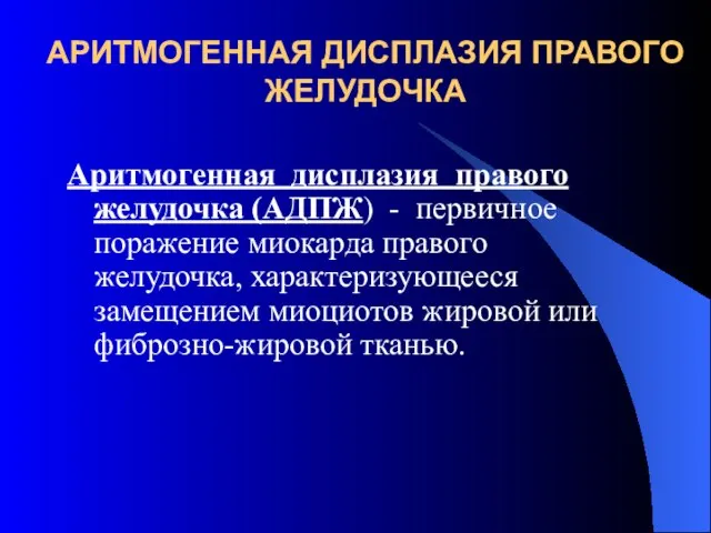 АРИТМОГЕННАЯ ДИСПЛАЗИЯ ПРАВОГО ЖЕЛУДОЧКА Аритмогенная дисплазия правого желудочка (АДПЖ) - первичное