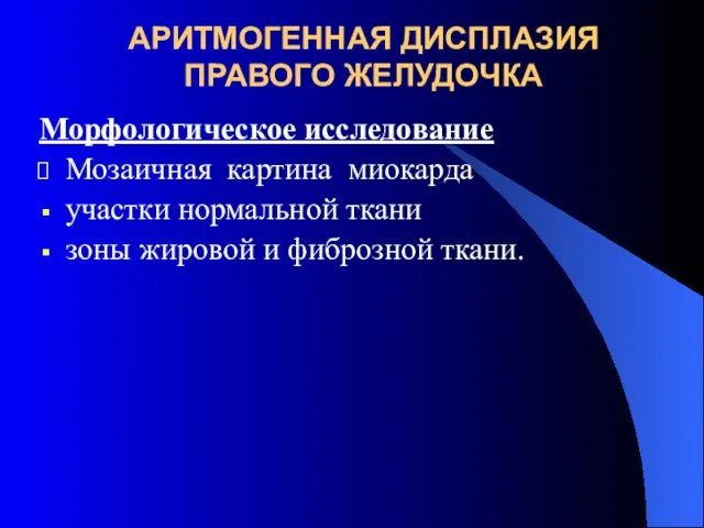 АРИТМОГЕННАЯ ДИСПЛАЗИЯ ПРАВОГО ЖЕЛУДОЧКА Морфологическое исследование Мозаичная картина миокарда участки нормальной