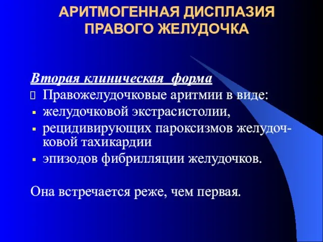 АРИТМОГЕННАЯ ДИСПЛАЗИЯ ПРАВОГО ЖЕЛУДОЧКА Вторая клиническая форма Правожелудочковые аритмии в виде: