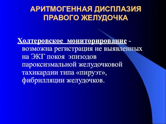 АРИТМОГЕННАЯ ДИСПЛАЗИЯ ПРАВОГО ЖЕЛУДОЧКА Холтеровское мониторирование - возможна регистрация не выявленных