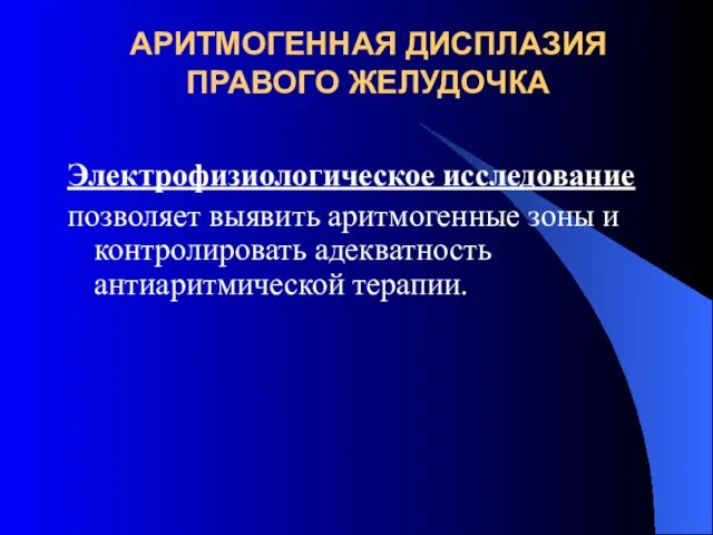 АРИТМОГЕННАЯ ДИСПЛАЗИЯ ПРАВОГО ЖЕЛУДОЧКА Электрофизиологическое исследование позволяет выявить аритмогенные зоны и контролировать адекватность антиаритмической терапии.