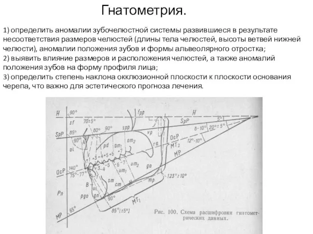 Гнатометрия. 1) определить аномалии зубочелюстной системы развившиеся в результате несоответствия размеров