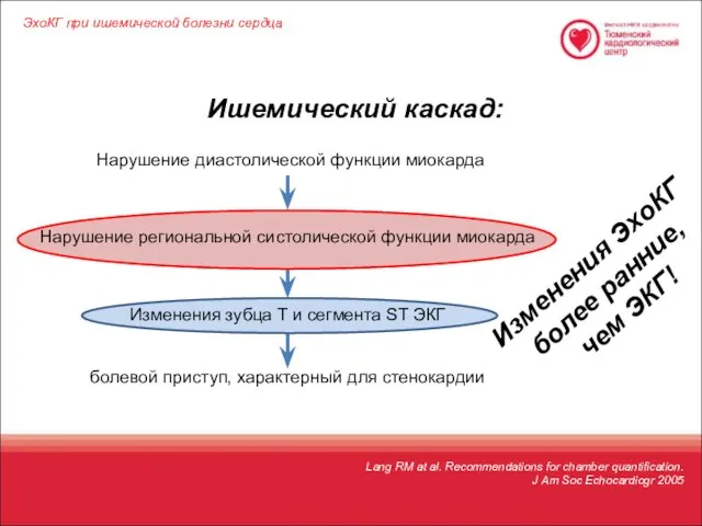 ЭхоКГ при ишемической болезни сердца Нарушение региональной систолической функции миокарда Ишемический