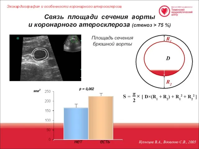 D R2 R1 Кузнецов В.А., Вдовенко С.В., 2005 Связь площади сечения