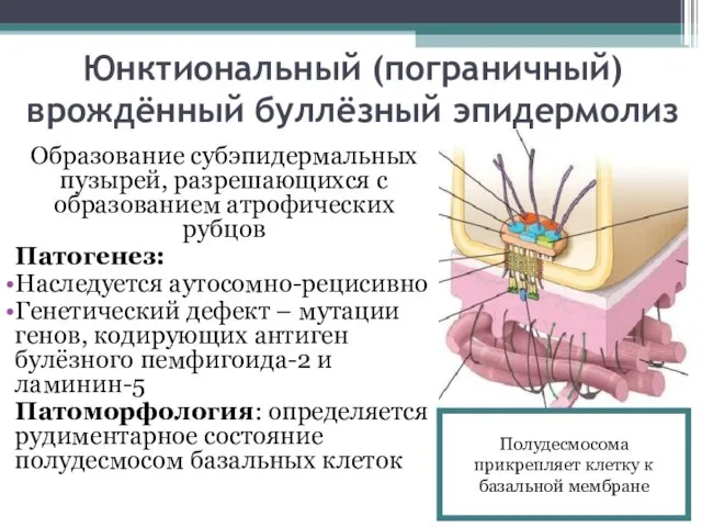 Юнктиональный (пограничный) врождённый буллёзный эпидермолиз Образование субэпидермальных пузырей, разрешающихся с образованием