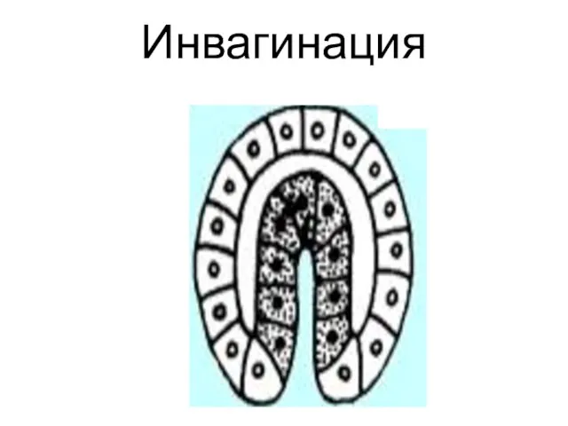 Инвагинация