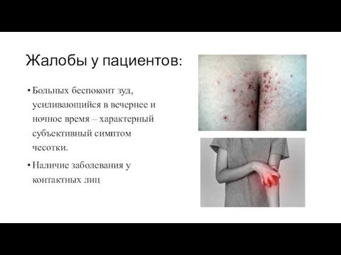 Жалобы у пациентов: Больных беспокоит зуд, усиливающийся в вечернее и ночное