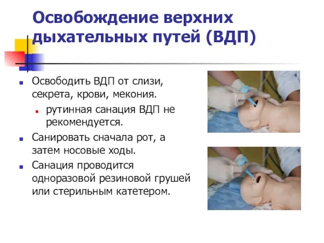 Освобождение верхних дыхательных путей (ВДП) Освободить ВДП от слизи, секрета, крови,