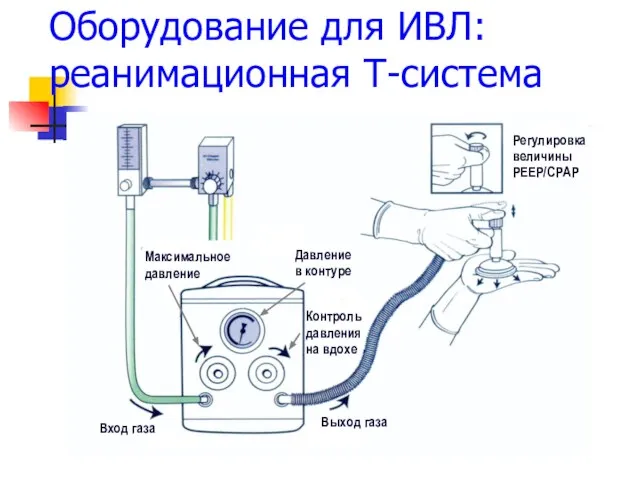 Оборудование для ИВЛ: реанимационная Т-система Выход газа Вход газа Давление в