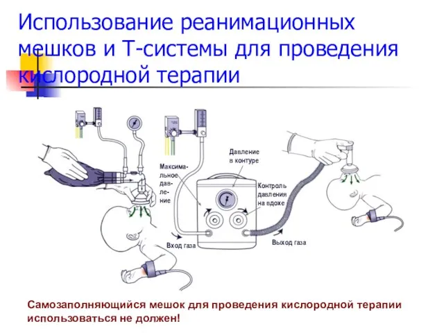 Использование реанимационных мешков и Т-системы для проведения кислородной терапии Самозаполняющийся мешок