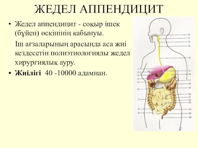 ЖЕДЕЛ АППЕНДИЦИТ Жедел аппендицит - соқыр ішек (бұйен) өскінінің кабынуы. Іш