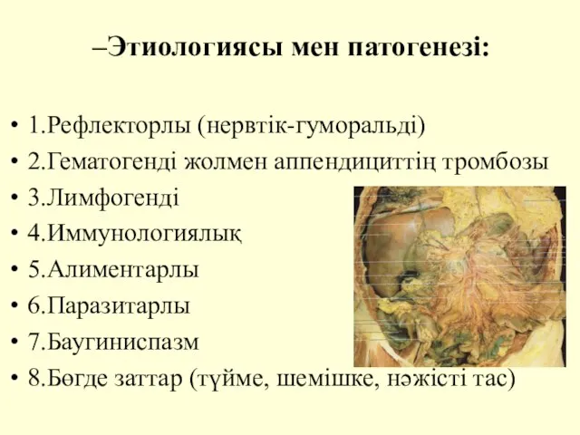 Этиологиясы мен патогенезі: 1.Рефлекторлы (нервтік-гуморальді) 2.Гематогенді жолмен аппендициттің тромбозы 3.Лимфогенді 4.Иммунологиялық