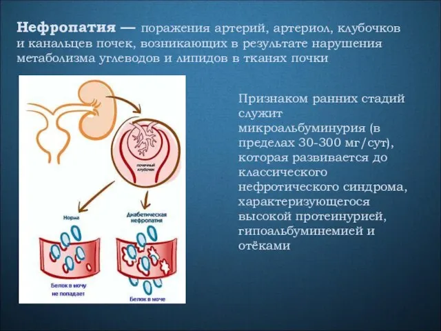 Нефропатия — поражения артерий, артериол, клубочков и канальцев почек, возникающих в