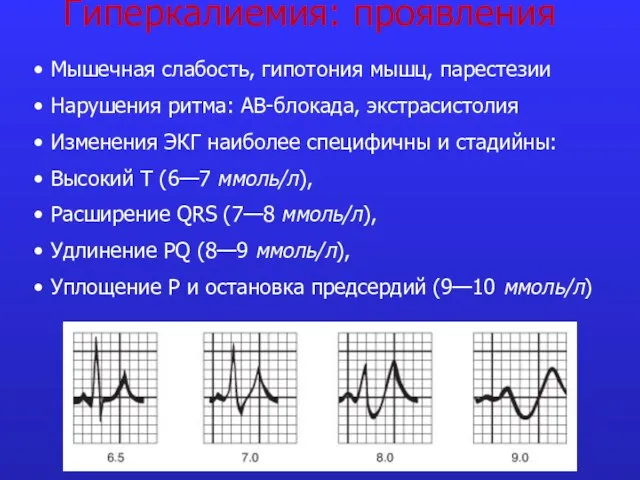 Гиперкалиемия: проявления Мышечная слабость, гипотония мышц, парестезии Нарушения ритма: АВ-блокада, экстрасистолия