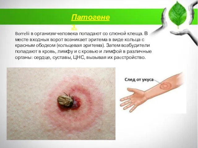 Патогенез. Borrelii в организм человека попадают со слюной клеща. В месте