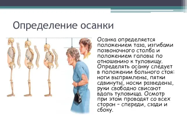 Определение осанки Осанка определяется положением таза, изгибами позвоночного столба и положением