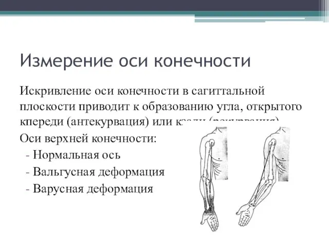 Измерение оси конечности Искривление оси конечности в сагиттальной плоскости приводит к