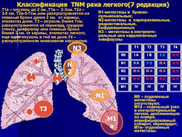 Т1а – опухоль до 2 см.,Т1в – 2-3см. Т2а – 3-5