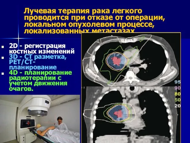 Лучевая терапия рака легкого проводится при отказе от операции, локальном опухолевом