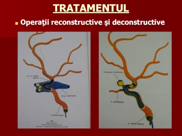 TRATAMENTUL Operaţii reconstructive şi deconstructive