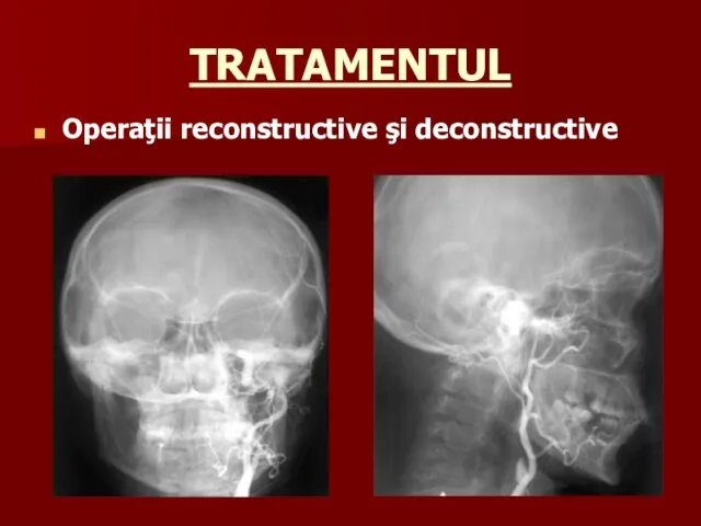 TRATAMENTUL Operaţii reconstructive şi deconstructive