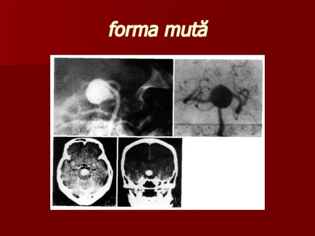 forma mută