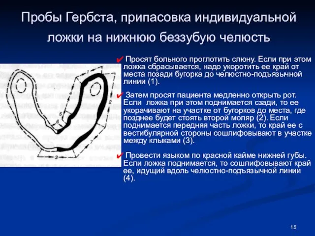 Пробы Гербста, припасовка индивидуальной ложки на нижнюю беззубую челюсть Просят больного