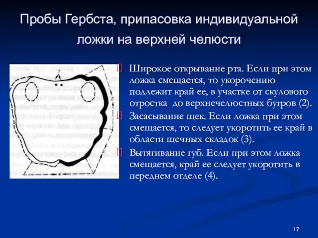 Пробы Гербста, припасовка индивидуальной ложки на верхней челюсти Широкое открывание рта.