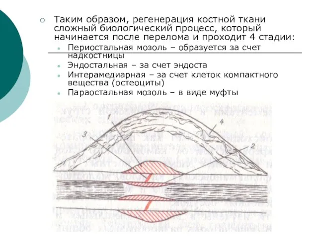 Таким образом, регенерация костной ткани сложный биологический процесс, который начинается после