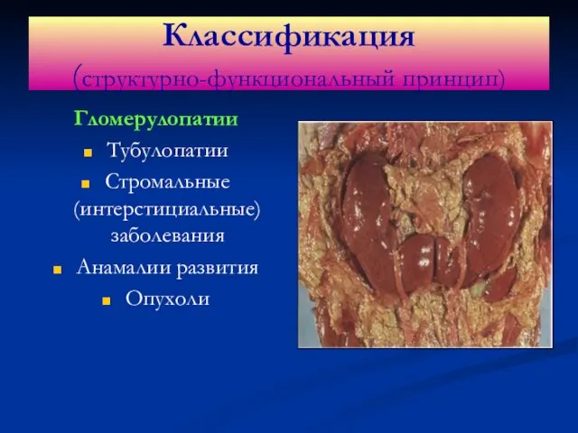Классификация (структурно-функциональный принцип) Гломерулопатии Тубулопатии Стромальные (интерстициальные) заболевания Анамалии развития Опухоли