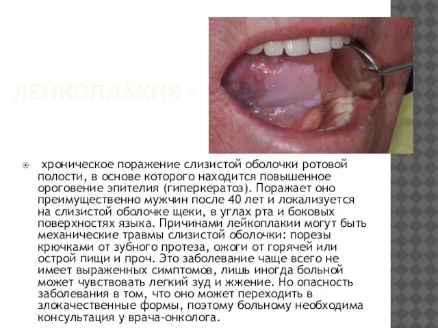 ЛЕЙКОПЛАКИЯ - хроническое поражение слизистой оболочки ротовой полости, в основе которого