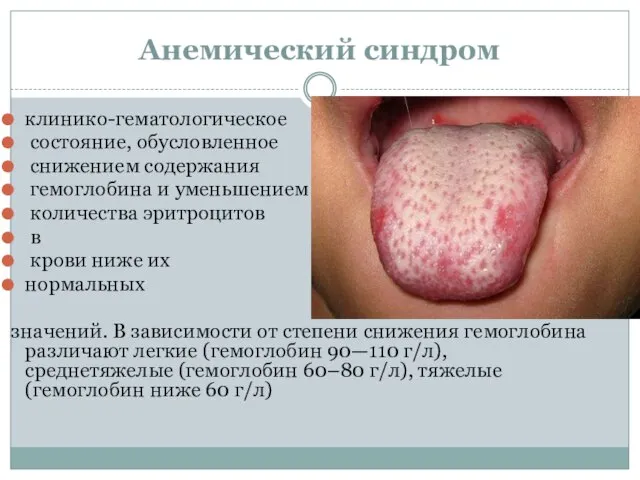 Анемический синдром клинико-гематологическое состояние, обусловленное снижением содержания гемоглобина и уменьшением количества