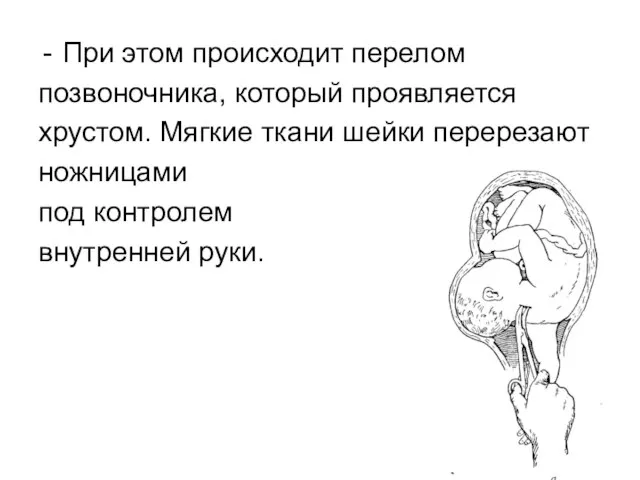 При этом происходит перелом позвоночника, который проявляется хрустом. Мягкие ткани шейки