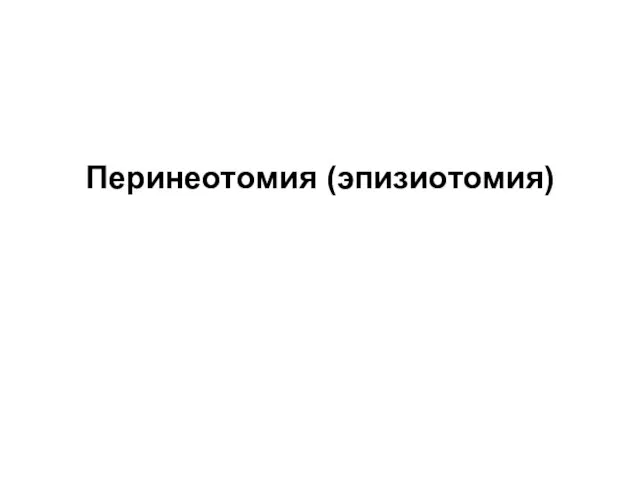 Перинеотомия (эпизиотомия)