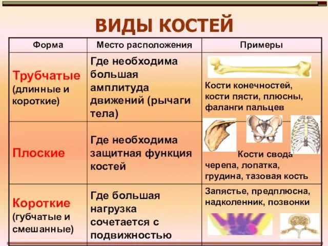 ВИДЫ КОСТЕЙ