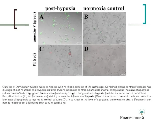 Клинический институт Мозга Cultures at Day 3 after hypoxia were compared